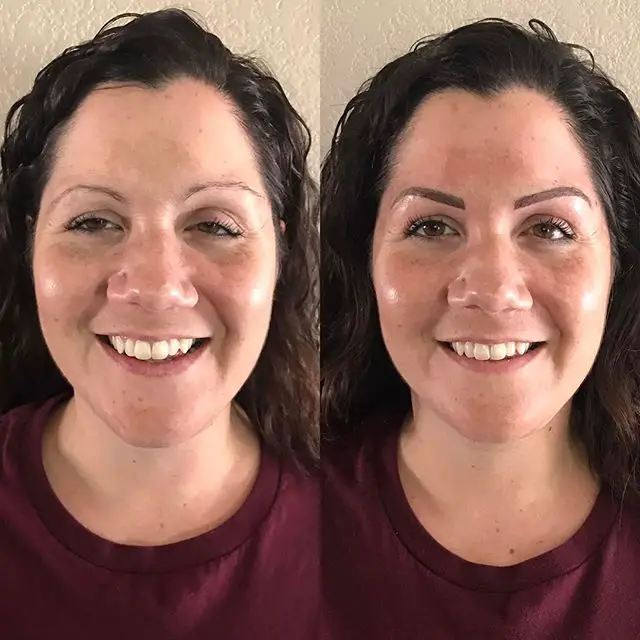 kara front before after scar microblading