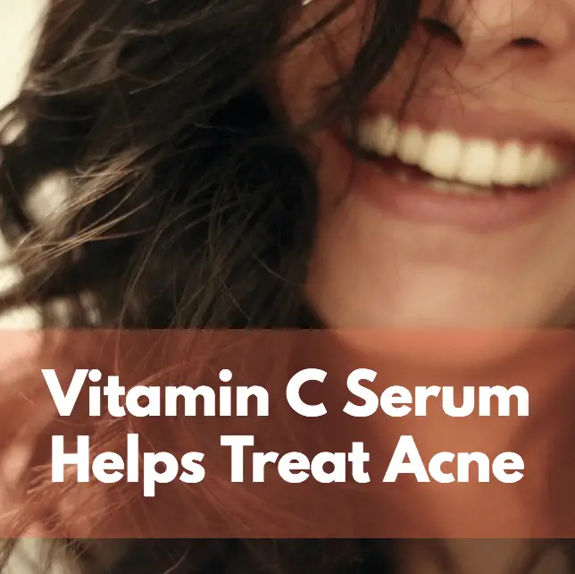 Vitamin C serum helps treat acne