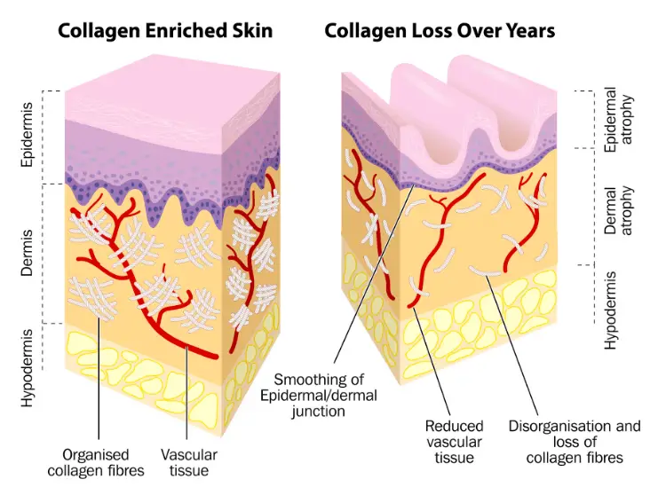 Vitamin c increases collagen in the dermis