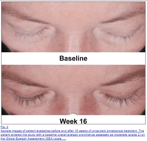 eyelash before and after growth serum