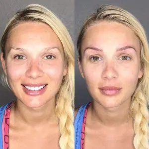 Microblading before and after frontal picture
