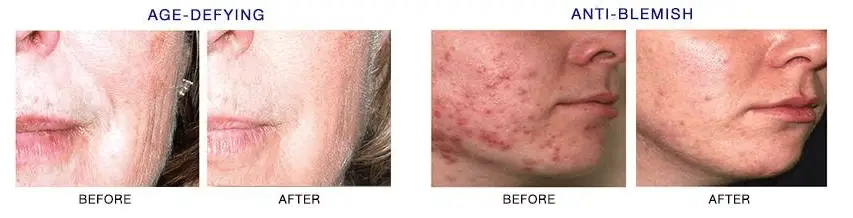 is clinical active serum before and after pictures