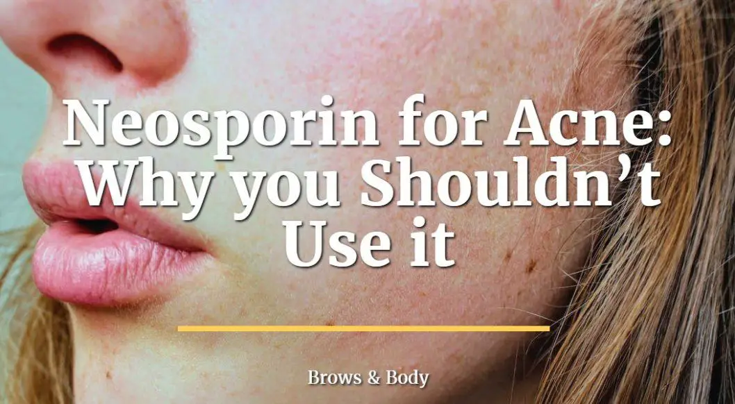 neosporin for acne and why you shouldn't use it.